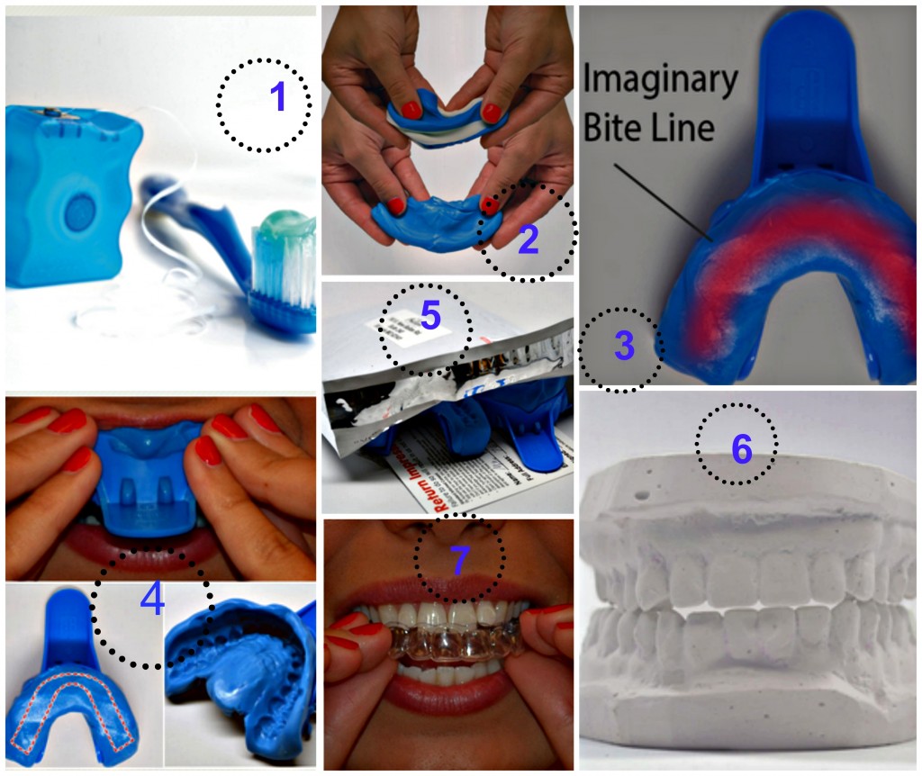 Dientes